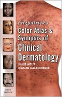 Fitzpatrick's Color Atlas and Synopsis of Clinical Dermatology: Sixth Edition