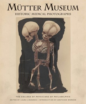 Mutter Museum Historic Medical Photographs: The College of Physicians of Philadelphia
