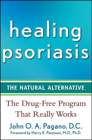Healing Psoriasis: The Natural Alternative