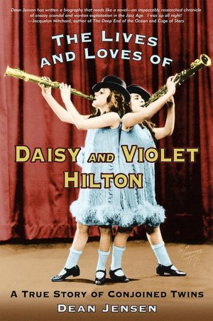 Lives and Loves of Daisy and Violet Hilton: A True Story of Conjoined Twins