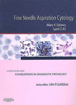 Fine Needle Aspiration Cytology: A Volume in Foundations in Diagnostic Pathology