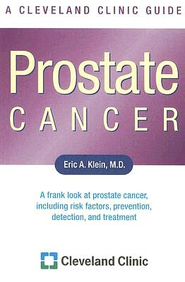 Prostate Cancer: A Cleveland Clinic Guide