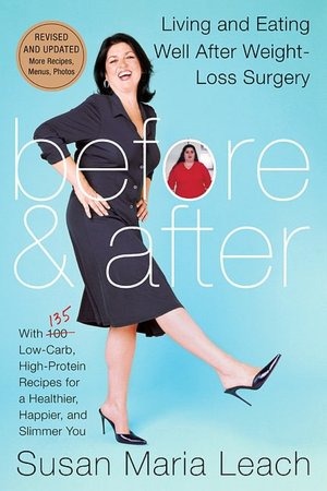Before and After: Living and Eating Well After Weight-Loss Surgery (Revised Edition)