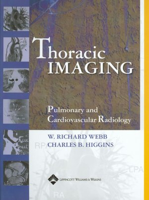 Thoracic Imaging: Pulmonary and Cardiovascular radiology