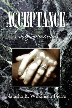 Acceptance