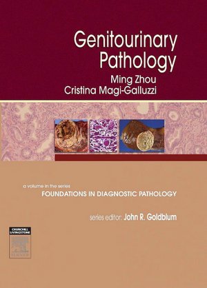 Genitourinary Pathology: A Volume in Foundations in Diagnostic Pathology Series