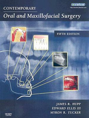 Contemporary Oral and Maxillofacial Surgery