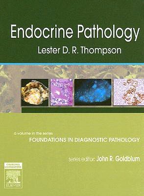 Endocrine Pathology: A Volume in Foundations in Diagnostic Pathology Series