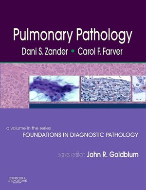 Pulmonary Pathology: A Volume in Foundations in Diagnostic Pathology Series
