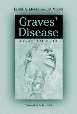 Graves' Disease: A Practical Guide