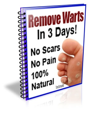 Remove Warts In 3 Days