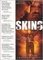 Skins