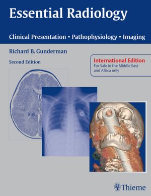 Essential Radiology: Clinical Presentation ? Pathophysiology ? Imaging