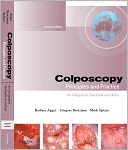Colposcopy: Principles and Practice