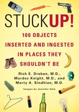 Free book download in pdf Stuck Up!: 100 Objects Inserted and Ingested in Places They Shouldn't Be iBook 9780312680084