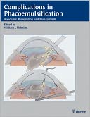 Complications in Phacoemulsification: Avoidance, Recognition, and Management