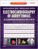 Electrocardiography of Arrhythmias: A Comprehensive Review: A Companion to Cardiac Electrophysiology: Expert Consult - Online and Print