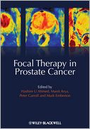 Focal Therapy in Prostate Cancer