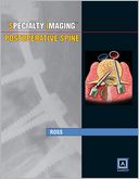 Postoperative Spine: Published by Amirsys
