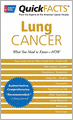 Quick Facts Lung Cancer: What You Need to Know--Now