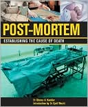 Postmortem: Establishing the Cause of Death