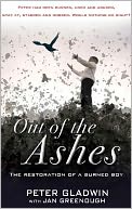 Out of the Ashes: The Restoration of a Burned Boy
