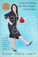 Before and After: Living and Eating Well After Weight-Loss Surgery (Revised Edition)