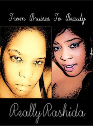 From Bruises To Beauty