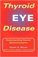 Thyroid Eye Disease: Understanding Graves' Ophthalmopathy