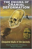 The Enigma of Cranial Deformation: Elongated Skulls of the Ancients