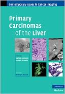 Primary Carcinomas of the Liver