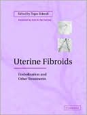 Uterine Fibroids: Embolization and other Treatments