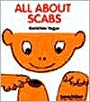 All about Scabs