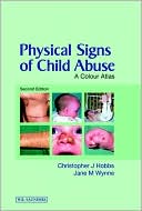 Physical Signs of Child Abuse