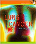 Lung Cancer Health Alert Series)