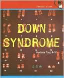 Down Syndrome