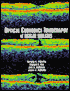 Optical Coherence Tomography of Ocular Diseases