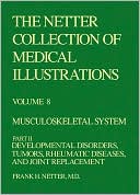 The Netter Collection of Medical Illustrations - Musculoskeletal System: Part II - Developmental Disorders, Tumors, Rheumatic Diseases and Joint Replacements