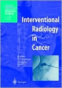 Interventional Radiology in Cancer