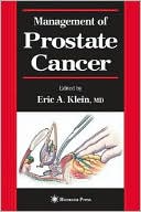 Management of Prostate Cancer