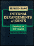 Internal Derangements of Joints: Emphasis on MR Imaging