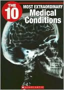 10 Most Extraordinary Medical Conditions