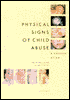 Physical Signs in Child Abuse