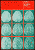Magnetic Resonance in Multiple Sclerosis