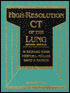High-Resolution CT of the Lung