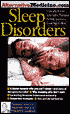 Sleep Disorders