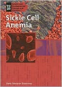Sickle Cell Anemia