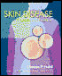 Skin Disease: Diagnosis and Treatment