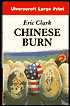 Chinese Burn