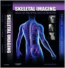 Skeletal Imaging: Atlas of the Spine and Extremities